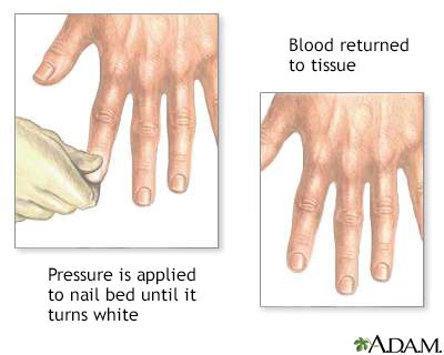 testing capillary refill on thick and yellow nail|capillary nail refill test pdf.